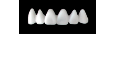 Cod.E1UPPER ANTERIOR : 10x  wax facings-bridges (hollow), LARGE, Tapering ovoid, (13-23), compatible with solid (not  hollow) wax bridges Cod.S1UPPER ANTERIOR, (13-23)
